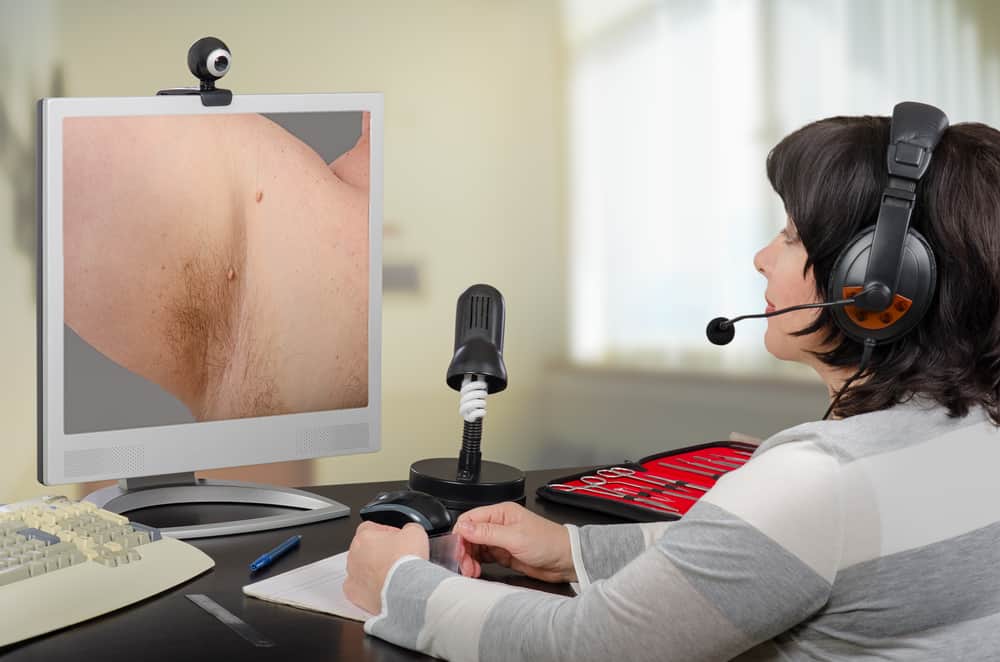 a doctor looking at an image of skin tags in an armpit