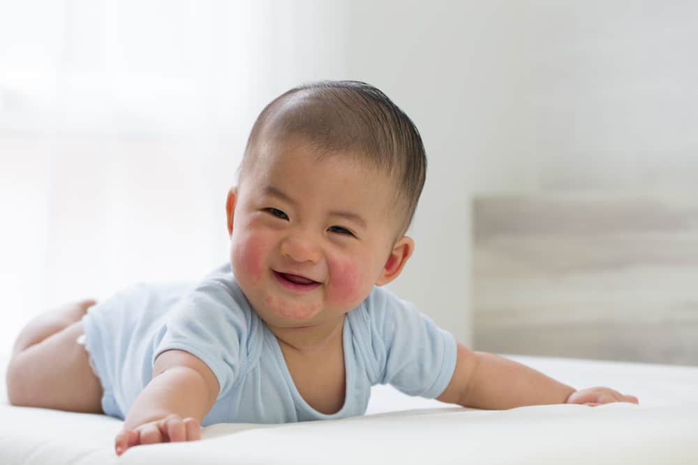 Asian baby with acne smiling on a bed