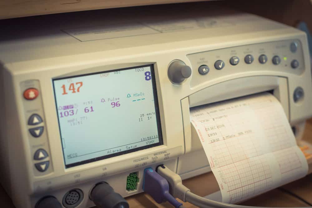 fetal heart monitor displaying heart rate